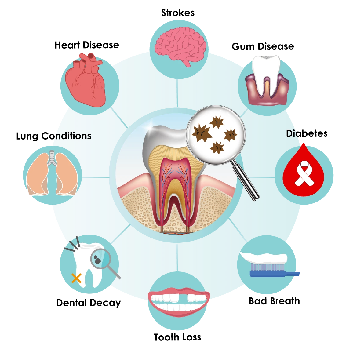 periodontal therapy | diagram showing periodontal disease