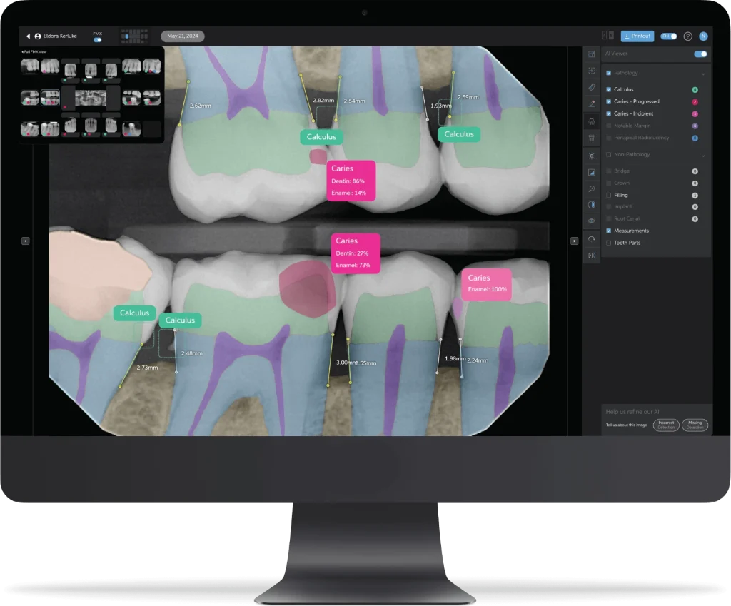 Pearl AI - modern dental software for advanced diagnosis